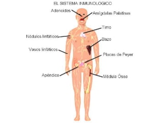 Lupus