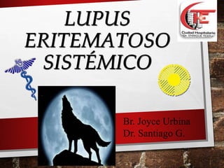 LUPUS
ERITEMATOSO
SISTÉMICO
Br. Joyce Urbina
Dr. Santiago G.
 