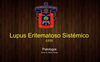Lupus Eritematoso Sistémico
(LES)
Patología
Oscar E. Romo Flores
 