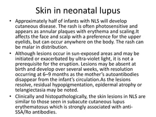 Skin in neonatal lupus
• Approximately half of infants with NLS will develop
cutaneous disease. The rash is often photosensitive and
appears as annular plaques with erythema and scaling.It
affects the face and scalp with a preference for the upper
eyelids, but can occur anywhere on the body. The rash can
be malar in distribution.
• Although lesions occur in sun-exposed areas and may be
initiated or exacerbated by ultra-violet light, it is not a
prerequisite for the eruption. Lesions may be absent at
birth and develop over several weeks, with resolution
occurring at 6–9 months as the mother’s autoantibodies
disappear from the infant’s circulation.As the lesions
resolve, residual hypopigmentation, epidermal atrophy or
telangiectasia may be noted.
• Clinically and histopathologically, the skin lesions in NLS are
similar to those seen in subacute cutaneous lupus
erythematosus which is strongly associated with anti-
SSA/Ro antibodies.
 
