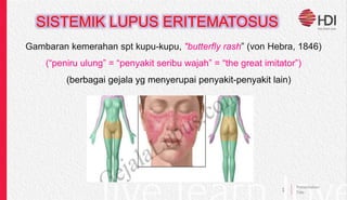 SISTEMIK LUPUS ERITEMATOSUS
1
Presentation
Title
Gambaran kemerahan spt kupu-kupu, "butterfly rash” (von Hebra, 1846)
(“peniru ulung” = “penyakit seribu wajah” = “the great imitator”)
(berbagai gejala yg menyerupai penyakit-penyakit lain)
 