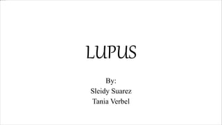 LUPUS
By:
Sleidy Suarez
Tania Verbel
 