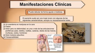 Puede debutar de forma aguda o insidiosa.
 Un exantema en mariposa en la cara
 Fiebre
 Dolor pero no deformidad, en una o más de las articulaciones
periféricas (pies, tobillos, rodillas, caderas, dedos de las manos,
muñecas, codos, hombros)
 Dolor torácico pleurítico
 Fotosensibilidad.
El paciente suele ser una mujer joven con algunas de las
siguientes características, aunque no necesariamente todas:
 