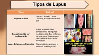 Tipos ¿Qué es?
Lupus Cutáneo
Llamado también Lupus
Discoide, solamente ataca la
piel.
Lupus inducido por
medicamento
Puede aparecer como
consecuencia de algunos
medicamentos. Sus síntomas,
generalmente desaparecen
después de suspender la
medicación..
Lupus Eritematoso Sistémico Ataca múltiples aparatos y
sistemas en el organismo.
 