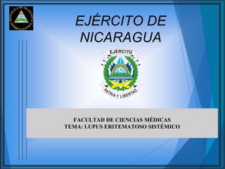 EJÉRCITO DE
NICARAGUA
FACULTAD DE CIENCIAS MÉDICAS
TEMA: LUPUS ERITEMATOSO SISTÉMICO
 