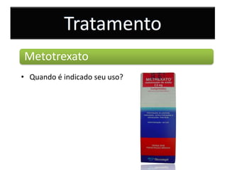 Tratamento
Metotrexato
• Quando é indicado seu uso?
 