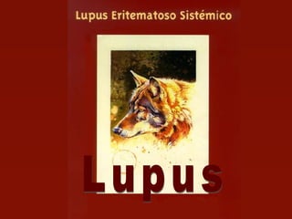 Lupus 