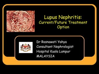 Lupus Nephritis: Current/Future Treatment Option Dr Rosnawati Yahya Consultant Nephrologist Hospital Kuala Lumpur MALAYSIA 