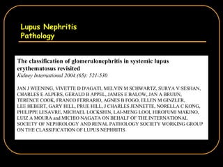 Lupus Nephritis Pathology The classification of glomerulonephritis in systemic lupus erythematosus revisited Kidney International 2004 (65): 521-530 JAN J WEENING, VIVETTE D D'AGATI, MELVIN M SCHWARTZ, SURYA V SESHAN, CHARLES E ALPERS, GERALD B APPEL, JAMES E BALOW, JAN A BRUIJN, TERENCE COOK, FRANCO FERRARIO, AGNES B FOGO, ELLEN M GINZLER, LEE HEBERT, GARY HILL, PRUE HILL, J CHARLES JENNETTE, NORELLA C KONG, PHILIPPE LESAVRE, MICHAEL LOCKSHIN, LAI-MENG LOOI, HIROFUMI MAKINO, LUIZ A MOURA and MICHIO NAGATA ON BEHALF OF THE INTERNATIONAL SOCIETY OF NEPHROLOGY AND RENAL PATHOLOGY SOCIETY WORKING GROUP ON THE CLASSIFICATION OF LUPUS NEPHRITIS 