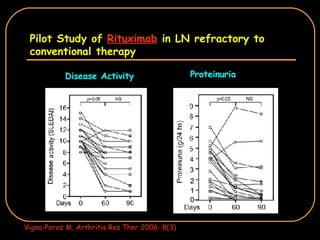 Pilot Study of  Rituximab  in LN refractory to conventional therapy Disease Activity Proteinuria Vigna-Perez M, Arthritis Res Ther 2006: 8(3) 