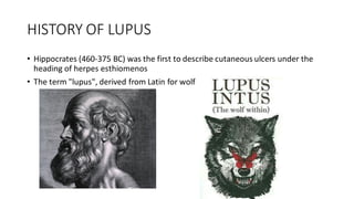 HISTORY OF LUPUS
• Hippocrates (460-375 BC) was the first to describe cutaneous ulcers under the
heading of herpes esthiomenos
• The term "lupus", derived from Latin for wolf
 