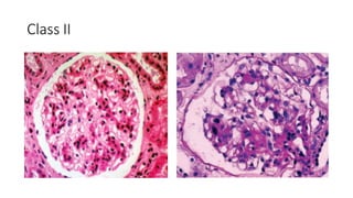 Class II
 