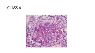 CLASS 4
 