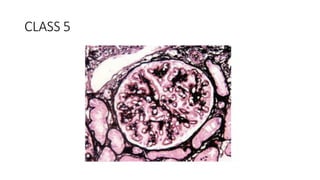 CLASS 5
 