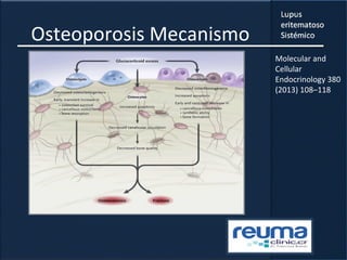 Osteoporosis Mecanismo
Molecular and
Cellular
Endocrinology 380
(2013) 108–118
 