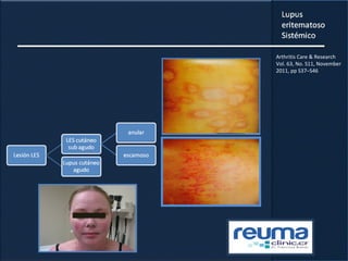 Arthritis Care & Research
Vol. 63, No. S11, November
2011, pp S37–S46
 