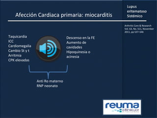 Afección Cardiaca primaria: miocarditis
Taquicardia
ICC
Cardiomegalia
Cambio St y t
Arritmia
CPK elevadas
Descenso en la FE
Aumento de
cavidades
Hipoquinesia o
acinesia
Anti Ro materno
RNP neonato
Arthritis Care & Research
Vol. 63, No. S11, November
2011, pp S37–S46
 