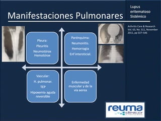 Manifestaciones Pulmonares
Arthritis Care & Research
Vol. 63, No. S11, November
2011, pp S37–S46
 