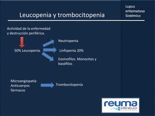 Leucopenia y trombocitopenia
Actividad de la enfermedad
y destrucción periférica.
50% Leucopenia.
Neutropenia
Linfopenia 20%
Eosinofilos. Monocitos y
basófilos
Microangiopatía
Anticuerpos
fármacos
Trombocitopenía
 