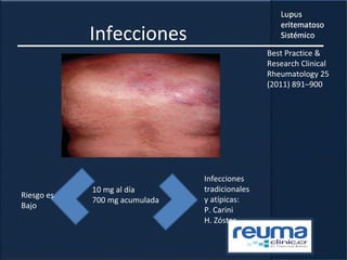Infecciones
10 mg al día
700 mg acumulada
Riesgo es
Bajo
Infecciones
tradicionales
y atípicas:
P. Carini
H. Zóster
Best Practice &
Research Clinical
Rheumatology 25
(2011) 891–900
 