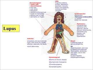Lupus Rash Distribution apa dan bagaimana lupus ? | PPT