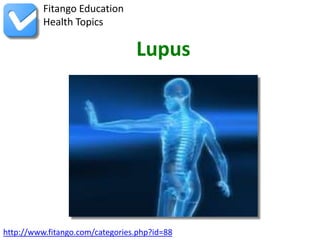 Fitango Education
          Health Topics

                                 Lupus




http://www.fitango.com/categories.php?id=88
 