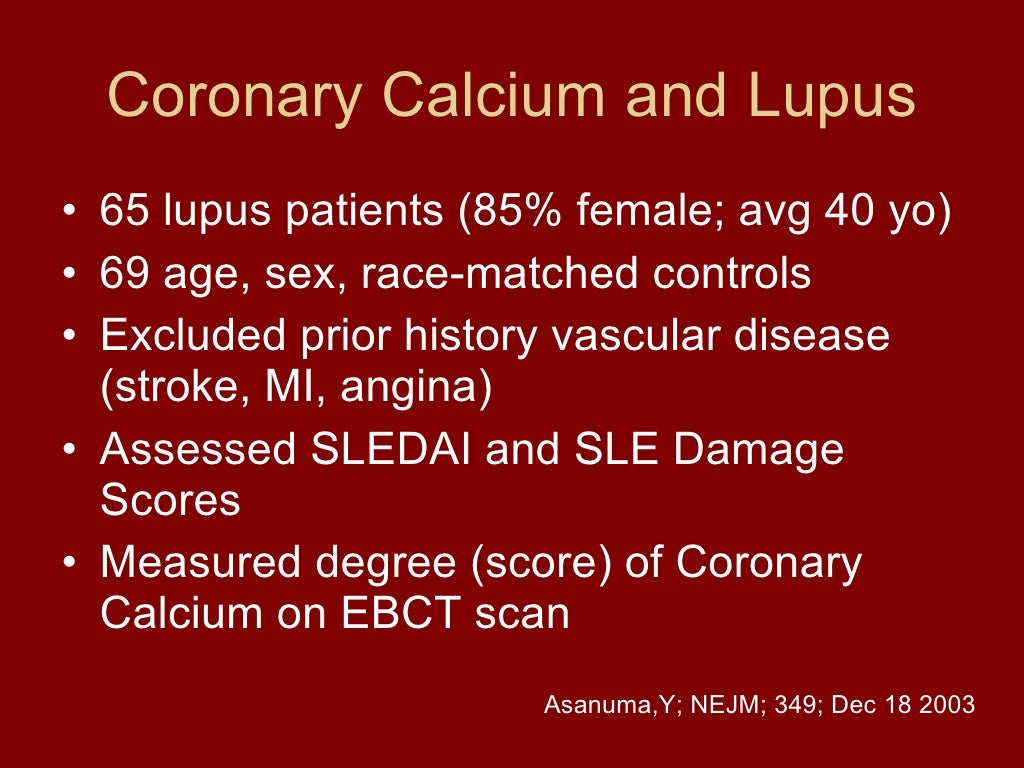 Lupus and cardiovascular disease