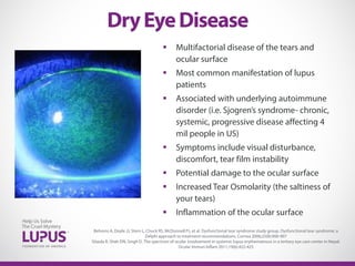  Multifactorial disease of the tears and
ocular surface
 Most common manifestation of lupus
patients
 Associated with underlying autoimmune
disorder (i.e. Sjogren’s syndrome- chronic,
systemic, progressive disease affecting 4
mil people in US)
 Symptoms include visual disturbance,
discomfort, tear film instability
 Potential damage to the ocular surface
 Increased Tear Osmolarity (the saltiness of
your tears)
 Inflammation of the ocular surface
DryEyeDisease
Behrens A, Doyle JJ, Stern L, Chuck RS, McDonnell PJ, et al. Dysfunctional tear syndrome study group. Dysfunctional tear syndrome: a
Delphi approach to treatment recommendations. Cornea 2006;25(8):900-907
Sitaula R, Shah DN, Singh D. The spectrum of ocular involvement in systemic lupus erythematosus in a tertiary eye care center in Nepal.
Ocular Immun Inflam 2011;19(6):422-425
 