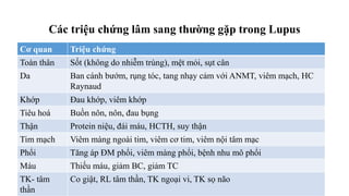 Các triệu chứng lâm sang thường gặp trong Lupus
Cơ quan Triệu chứng
Toàn thân Sốt (không do nhiễm trùng), mệt mỏi, sụt cân
Da Ban cánh bướm, rụng tóc, tang nhạy cảm với ANMT, viêm mạch, HC
Raynaud
Khớp Đau khớp, viêm khớp
Tiêu hoá Buồn nôn, nôn, đau bụng
Thận Protein niệu, đái máu, HCTH, suy thận
Tim mạch Viêm màng ngoài tim, viêm cơ tim, viêm nội tâm mạc
Phổi Tăng áp ĐM phổi, viêm màng phổi, bệnh nhu mô phổi
Máu Thiếu máu, giảm BC, giảm TC
TK- tâm
thần
Co giật, RL tâm thần, TK ngoại vi, TK sọ não
 