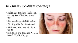 BAN ĐỎ HÌNH CÁNH BƯỚM Ở MẶT
• Xuất hiện: đợ tiến triển cấp tính,
sau tiếp xúc với ánh nắng mặt
trời
• Ban màu hồng, vết loét, phẳng
• Đáp ứng với điều trị corticoid
• Khỏi hoàn toàn, hoặc dát thâm,
teo da
• Sinh thiết: lắng đọng các PHMD,
bổ thể C3, C4, Clq, Ig
 