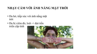 NHẠY CẢM VỚI ÁNH NẮNG MẶT TRỜI
• Da hở, tiếp xúc với ánh nắng mặt
trời
• Da bị viêm đỏ, loét -> đợt tiến
triển cấp tính
 
