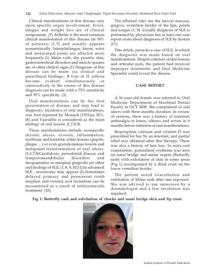 sle title report title report sle 28 images sle investigation report sle title report title report sle 28 images sle investigation report