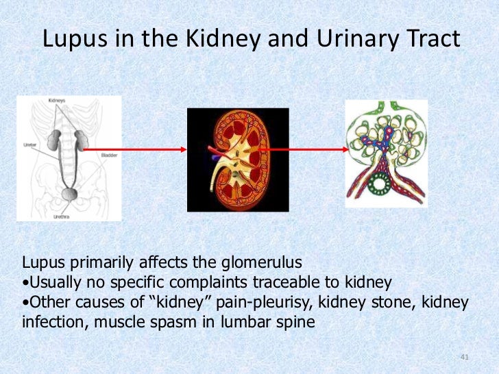 Lupus Lupus