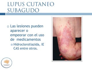  Las lesiones pueden
aparecer o
empeorar con el uso
de medicamentos
 Hidroclorotiazida, IE
CAS entre otros.
 