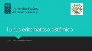 Lupus eritematoso sistémico
Diana Laura González Rodríguez
 