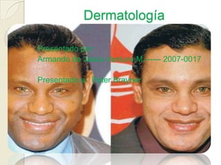 Dermatología

Presentado por:
Armando de Jesús Ventura M.------ 2007-0017

Presentado a: Peter Brayner
 