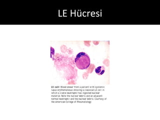 LE Hücresi
 