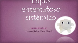 Lupus
eritematoso
sistémico
Susana Giselle Ci
Universidad Anáhuac Mayab
 