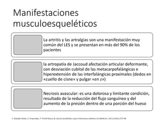 Manifestaciones
musculoesqueléticos
La artritis y las artralgias son una manifestación muy
común del LES y se presentan en más del 90% de los
pacientes
la artropatía de Jaccoud afectación articular deformante,
con desviación cubital de las metacarpofalángicas e
hiperextensión de las interfalángicas proximales (dedos en
«cuello de cisne» y pulgar «en z»)
Necrosis avascular: es una dolorosa y limitante condición,
resultado de la reducción del flujo sanguíneo y del
aumento de la presión dentro de una porción del hueso
 