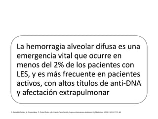 La hemorragia alveolar difusa es una
emergencia vital que ocurre en
menos del 2% de los pacientes con
LES, y es más frecuente en pacientes
activos, con altos títulos de anti-DNA
y afectación extrapulmonar
 