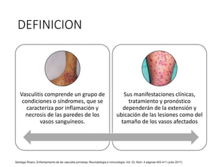 DEFINICION
Vasculitis comprende un grupo de
condiciones o síndromes, que se
caracteriza por inflamación y
necrosis de las paredes de los
vasos sanguíneos.
Sus manifestaciones clínicas,
tratamiento y pronóstico
dependerán de la extensión y
ubicación de las lesiones como del
tamaño de los vasos afectados
Santiago Rivero, Enfrentamiento de las vasculitis primarias, Reumatología e inmunología, Vol. 23. Núm. 4 páginas 403-411 (Julio 2017)
 