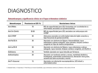 DIAGNOSTICO
E. Rabadán Rubio, V. Emperialea, P. Pretel Ruiza y N. García Castañedab, Lupus eritematoso sistémico (I), Medicine. 2021;13(31):1737-48
 