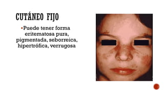 Puede tener forma
eritematosa pura,
pigmentada, seborreica,
hipertrófica, verrugosa
 