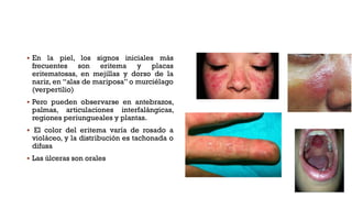  En la piel, los signos iniciales más
frecuentes son eritema y placas
eritematosas, en mejillas y dorso de la
nariz, en “alas de mariposa” o murciélago
(verpertilio)
 Pero pueden observarse en antebrazos,
palmas, articulaciones interfalángicas,
regiones periungueales y plantas.
 El color del eritema varía de rosado a
violáceo, y la distribución es tachonada o
difusa
 Las úlceras son orales
 