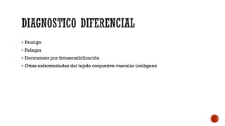  Prurigo
 Pelagra
 Dermatosis por fotosensibilización
 Otras enfermedades del tejido conjuntivo-vascular (colágeno
 