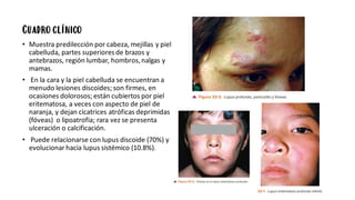 Cuadro clínico
• Muestra predilección por cabeza, mejillas y piel
cabelluda, partes superioresde brazos y
antebrazos, región lumbar, hombros,nalgas y
mamas.
• En la cara y la piel cabelluda se encuentran a
menudo lesiones discoides; son firmes, en
ocasiones dolorosos; están cubiertos por piel
eritematosa, a veces con aspecto de piel de
naranja, y dejan cicatrices atróficas deprimidas
(fóveas) o lipoatrofia; rara vez se presenta
ulceración o calcificación.
• Puede relacionarse con lupus discoide (70%) y
evolucionar hacia lupus sistémico (10.8%).
 