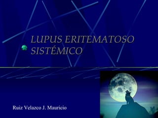 LUPUS ERITEMATOSO SISTÉMICO Ruiz Velazco J. Mauricio 