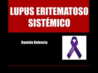 LUPUS ERITEMATOSO
    SISTÉMICO
  Daniela Valencia
 