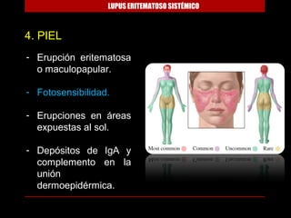 LUPUS ERITEMATOSO SISTÉMICO



4. PIEL
- Erupción eritematosa
  o maculopapular.

- Fotosensibilidad.

- Erupciones en áreas
  expuestas al sol.

- Depósitos de IgA y
  complemento en la
  unión
  dermoepidérmica.
 