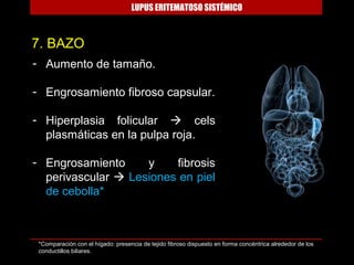 LUPUS ERITEMATOSO SISTÉMICO



7. BAZO
- Aumento de tamaño.

- Engrosamiento fibroso capsular.

- Hiperplasia folicular  cels
  plasmáticas en la pulpa roja.

- Engrosamiento     y    fibrosis
  perivascular  Lesiones en piel
  de cebolla*



 *Comparación con el hígado: presencia de tejido fibroso dispuesto en forma concéntrica alrededor de los
 conductillos biliares.
 